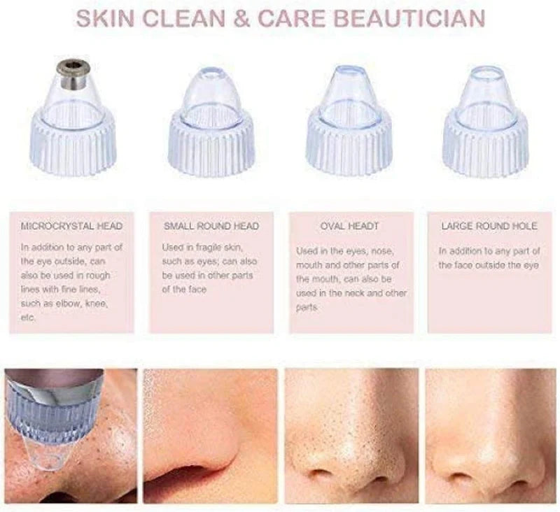 Blackhead Remover